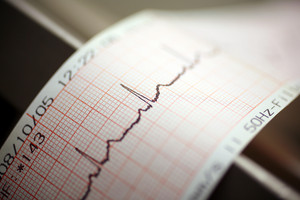 Close up EKG-Ausdruck