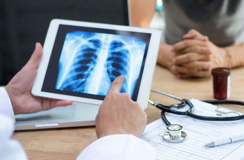 Man sieht die Hände eines Arztes, in denen er ein Tablet hält, auf dem eine radiologische Aufnahme eines Brustkorbes sieht.